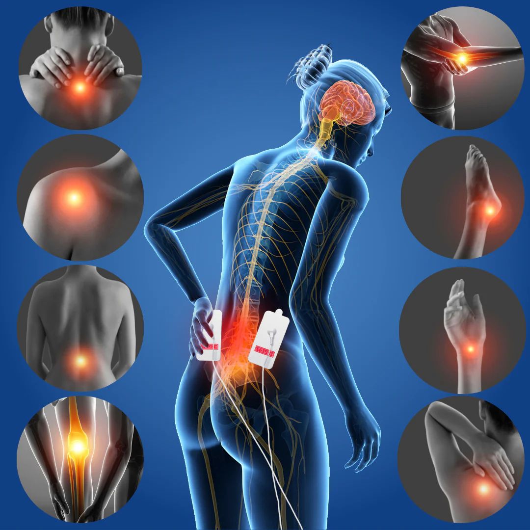 Pain Management physiotherapy treatment